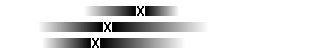 Diagram Hjärtsjukdomar