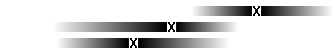 Diagram Leukemi hos vuxna